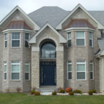 Shingles